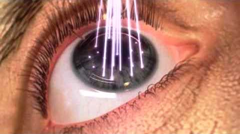 laser a eccimeri